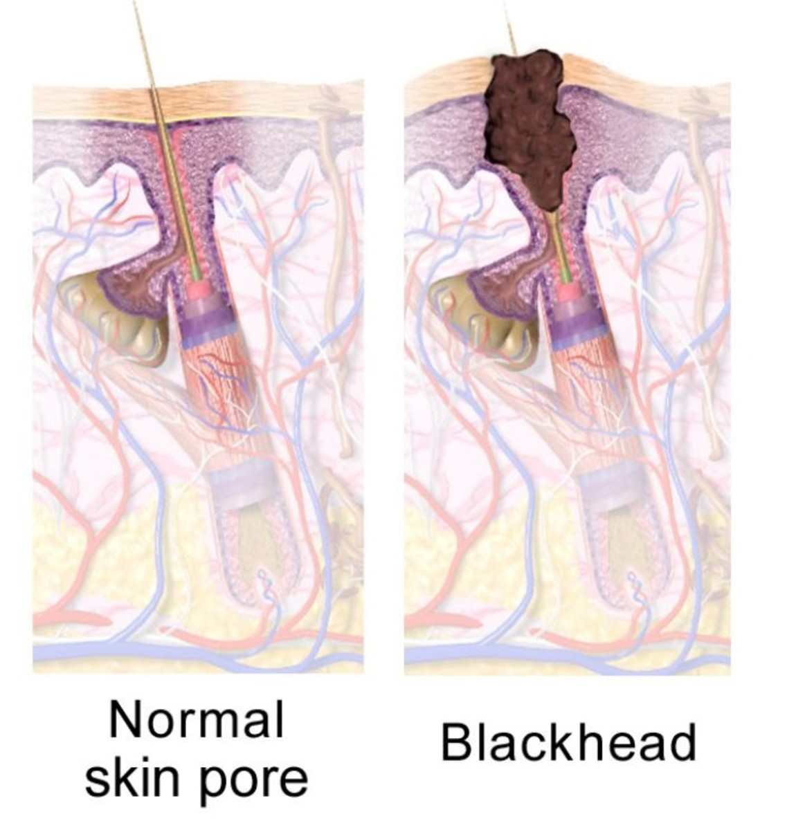 Dog Blackheads: What They Look Like and Treatment - PetHelpful